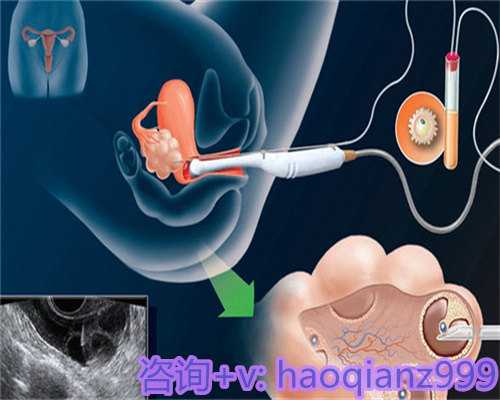 重庆试管助孕机构,助孕生子条件有哪些